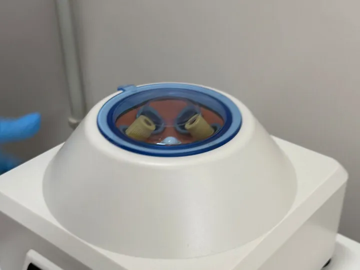 Coagulation study · Kit 4. Blue centrifuge lid with two visible tubes and a gloved hand.
