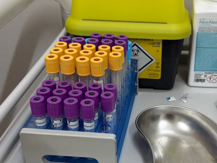Rack of collection tubes with coloured caps in the laboratory.
