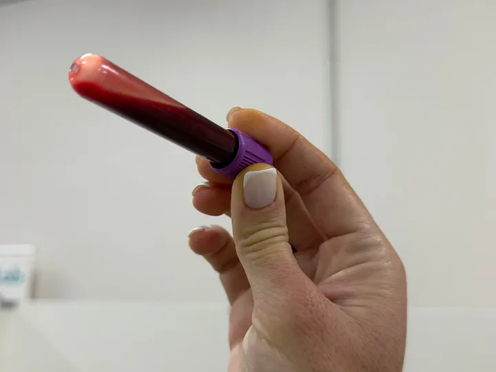 A hand holding a blood sample tube against a light wall.