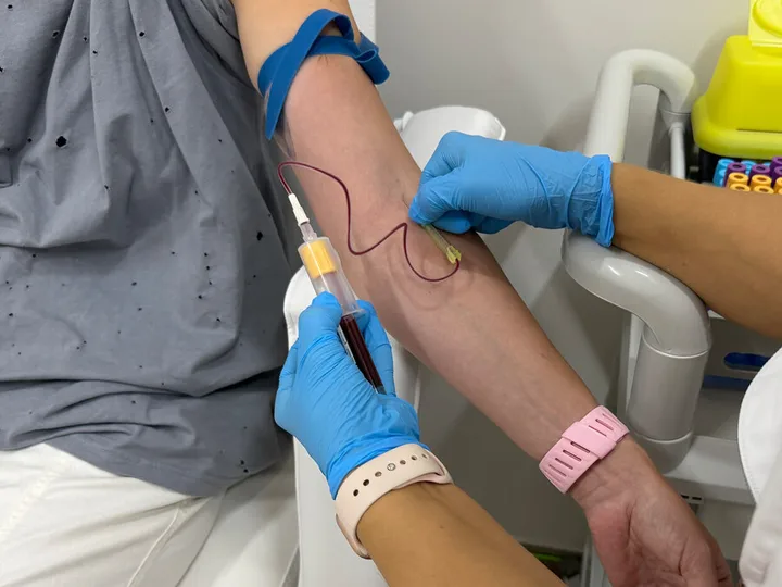 Guantes azules, tubo y línea de recogida de sangre junto a un brazo.