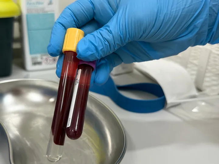 Blood sample tubes held in a blue-gloved hand.