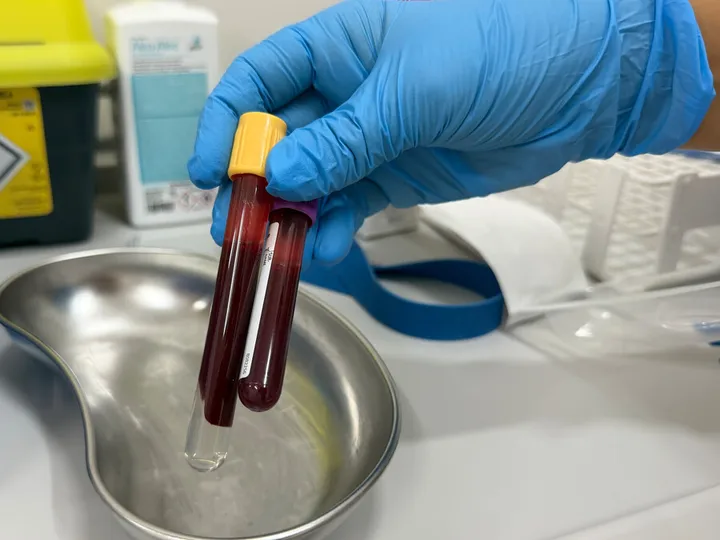 Blood sample tubes held in a blue-gloved hand.