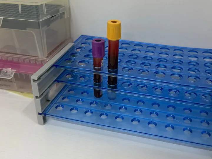 Two blood sample tubes in a blue rack.