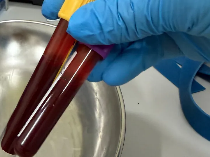 Two blood sample tubes held above a metal tray.