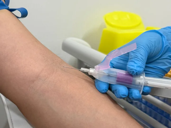Brazo con torniquete azul junto a guantes y material de extracción.