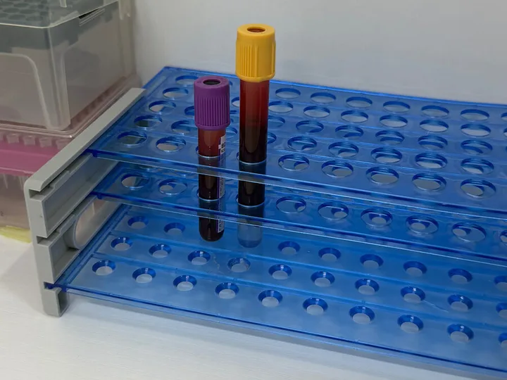 Two blood sample tubes in a blue rack.