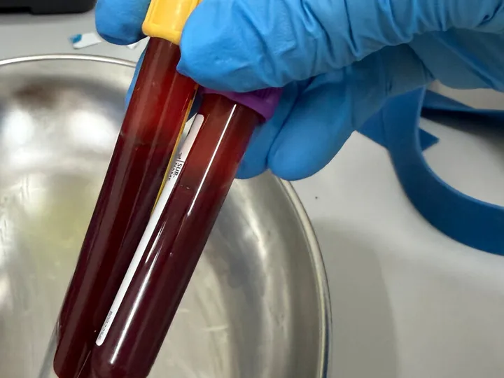 A blue-gloved hand holding two blood sample tubes.