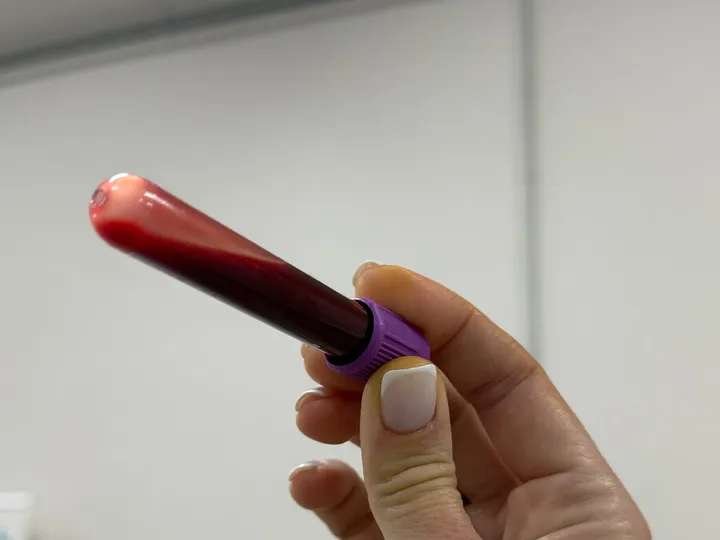Total T3 blood test · TT3. A hand holding a blood sample tube against a light wall.