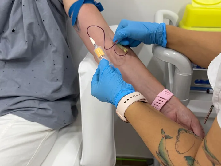 A blue glove and yellow-capped tube beside an arm.